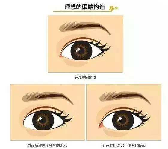 開內(nèi)眼角哪里好？想要做開眼角手術(shù)該如何選擇醫(yī)院