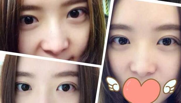 樸詩(shī)賢醫(yī)生-個(gè)人簡(jiǎn)介-口碑-韓國(guó)姿色zises整形外科