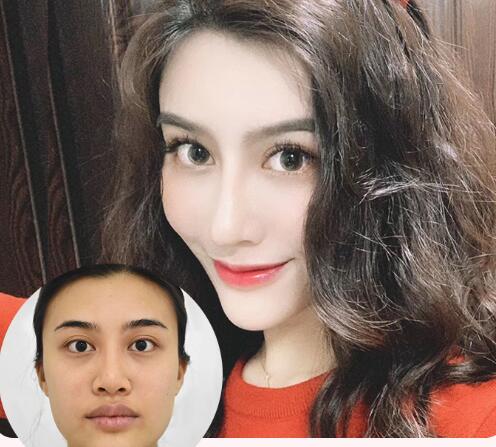 醫(yī)院因素：