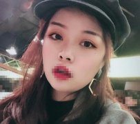 安徽省立醫(yī)院整形科杜曉揚(yáng)雙眼皮案例|美眼璨若星河！