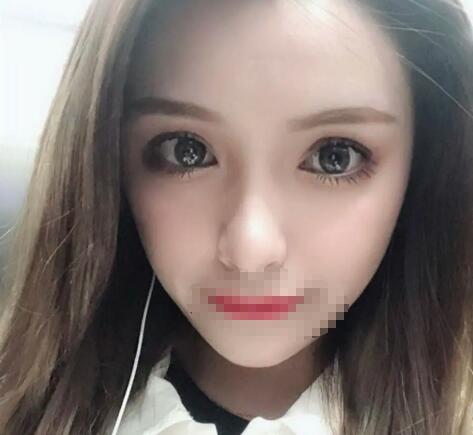 汕頭中心醫(yī)院整形美容科案例