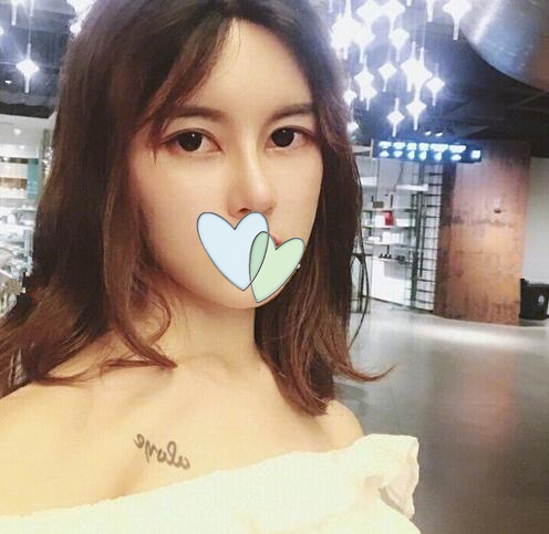 廣西中醫(yī)藥大學(xué)第一附屬醫(yī)院整形隆鼻案例