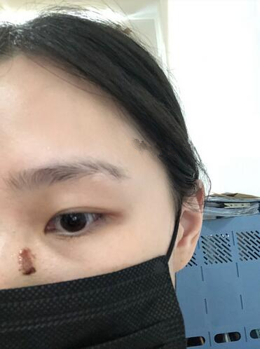 無錫第二人民醫(yī)院美容科去疤痕