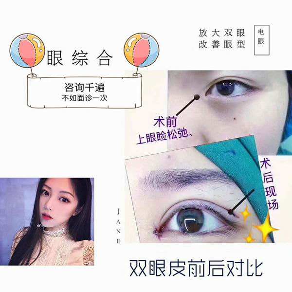 眼睛整形要多少錢？眼部綜合整形手術能改良的問題