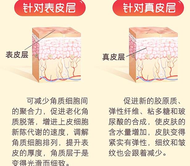 果酸煥膚是怎么回事？“換”掉的到底是什么？