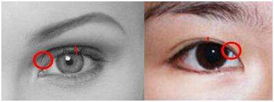 很多姑娘喜歡歐式雙眼皮，先看看這種形態(tài)適不適合你！