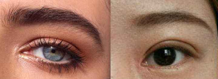 很多姑娘喜歡歐式雙眼皮，先看看這種形態(tài)適不適合你！