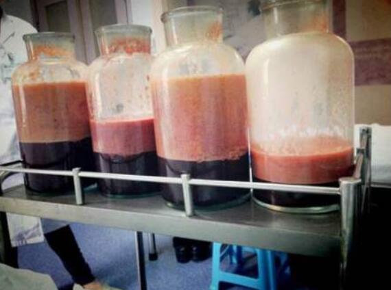 大腿肉注射瘦腿能打嗎?脂肪多打注射瘦腿是浪費(fèi)錢!