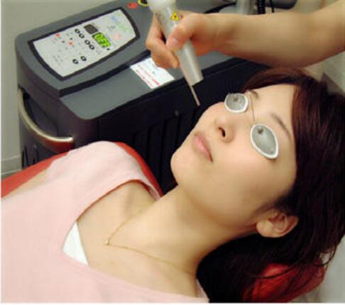 激光美容