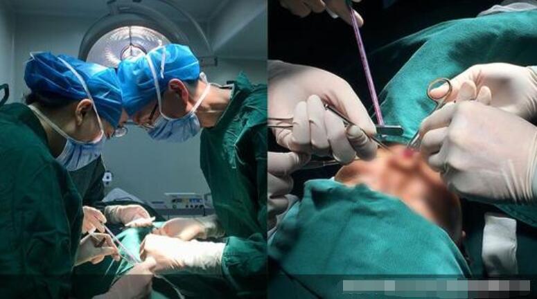 塌鼻梁做隆鼻手術(shù)怎么樣？有經(jīng)驗(yàn)醫(yī)美專家教你有避坑