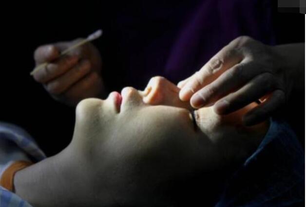 塌鼻梁做隆鼻手術(shù)怎么樣？有經(jīng)驗(yàn)醫(yī)美專家教你有避坑