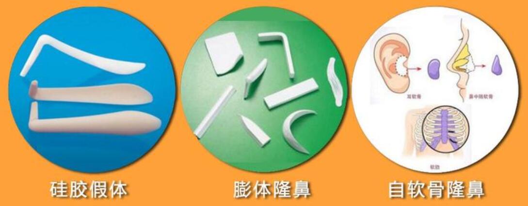 做隆鼻手術(shù)的材料有這些
