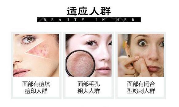 怎么去除痘印痘疤？網(wǎng)上方法太多你可以只認(rèn)準(zhǔn)這一種