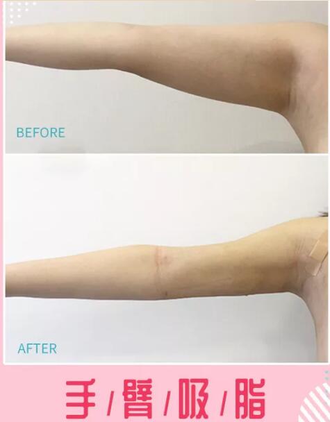 項(xiàng)目盤(pán)點(diǎn)：