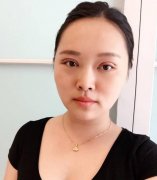 感受到了玻尿酸注射隆鼻果，小小一陣改變還挺大~