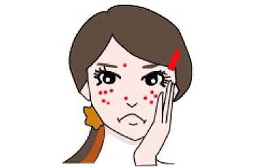 痘痘肌很煩惱，怎樣去除青春痘疤痕？還是得靠醫(yī)美