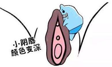 什么是陰唇漂紅手術(shù)?