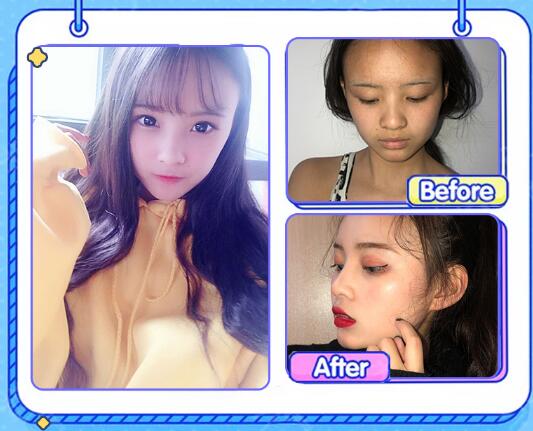 聶志宏醫(yī)生擅長(zhǎng)項(xiàng)目