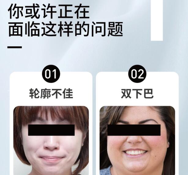 面部吸脂手術(shù)后戴幾天頭套?