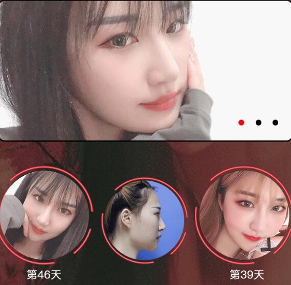 術(shù)后注意事項