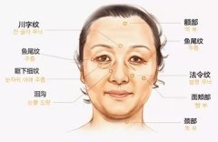 怎么樣去皺？方法讓人眼花繚亂到底哪個靠譜？