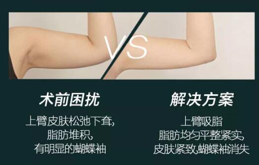 手臂吸脂手術術后注意事項