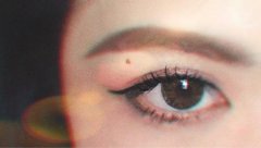 聽說雙眼皮失敗后不能馬上修復(fù)？修復(fù)的黃金時間要牢記