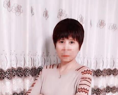 上眼皮松弛切除手術多少錢？術后果圖你品一品