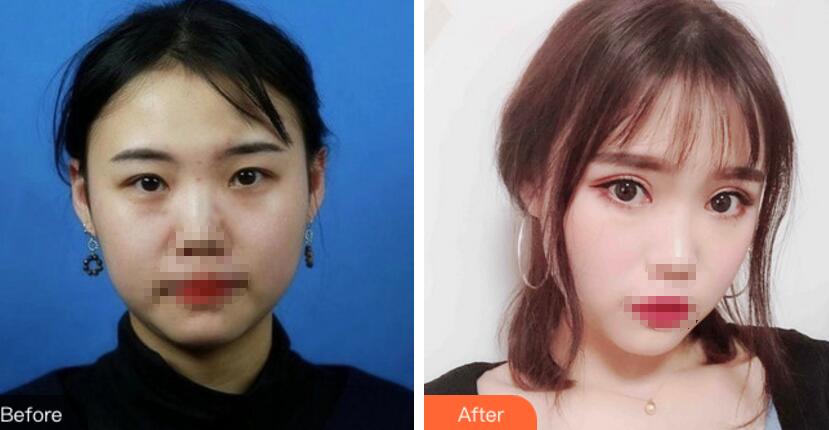 開灤總醫(yī)院整形美容科