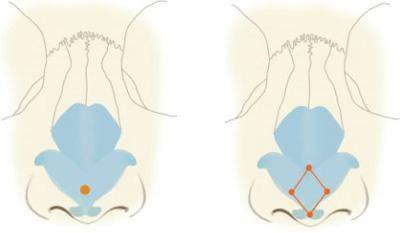 鼻頭塑形是什么項(xiàng)目？精致的鼻子鼻頭好看很重要！