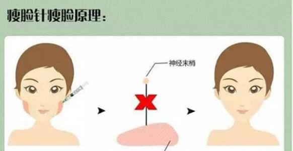 有哪些非手術(shù)瘦臉的方法？還是這個方法zui有