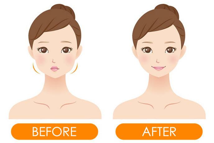 有哪些非手術(shù)瘦臉的方法？還是這個方法zui有