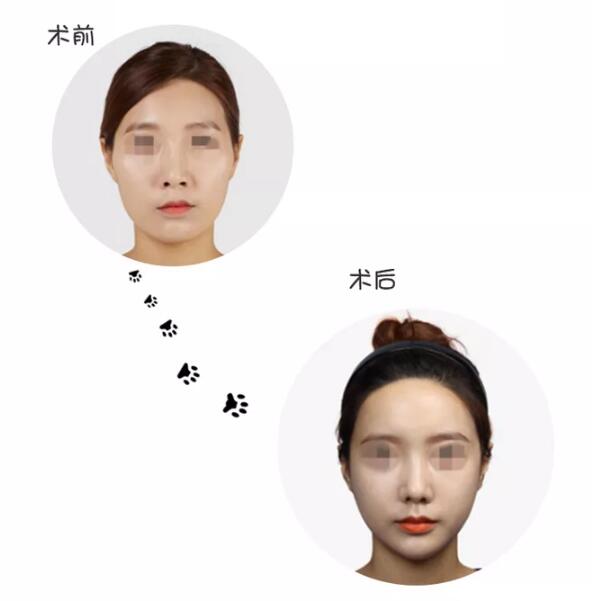 如何避免風(fēng)險(xiǎn)?