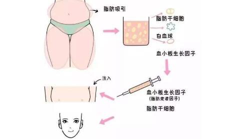 如何避免手術失敗?