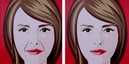 法令紋重！消滅法令紋的一些方法