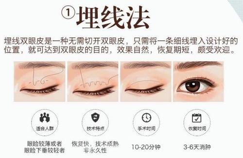 微創(chuàng)雙眼皮多久恢復(fù)自然