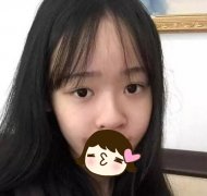 吳建利醫(yī)生給我做的硅膠隆鼻，你們覺得怎么樣？