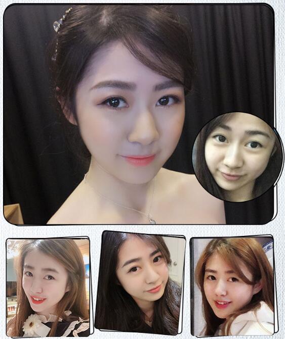 張琦醫(yī)生果圖