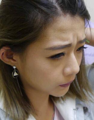 抬頭紋怎么祛除？這3種方法就很管用！