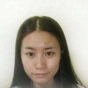 2020版本長春銘醫(yī)整形價格表，雙眼皮案例