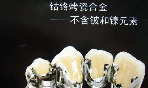 鈷鉻合金烤瓷牙材質(zhì)的優(yōu)劣點(diǎn)分析