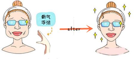 咬肌切除手術(shù)風(fēng)險(xiǎn)大么