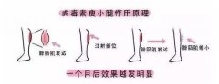 注射瘦腿有用嗎？簡(jiǎn)單分析原理，讓你瘦得放心！