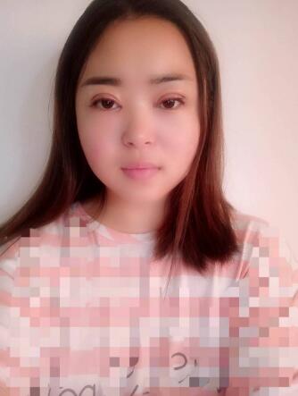 廣州武警醫(yī)院整形美容案例