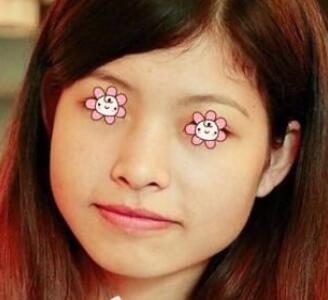 案例介紹手術(shù)前