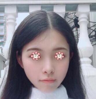 案例介紹手術(shù)前