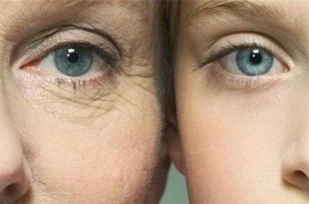 眼部除皺