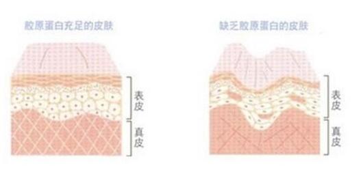 注射膠原蛋白手術(shù)前