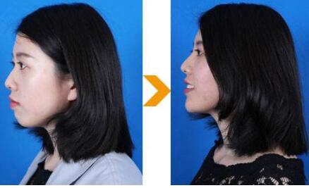 瑞蘭2號案例介紹