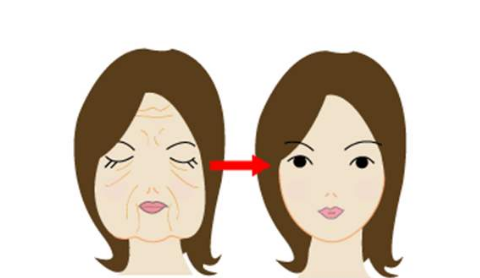 電波拉皮手術(shù)費用